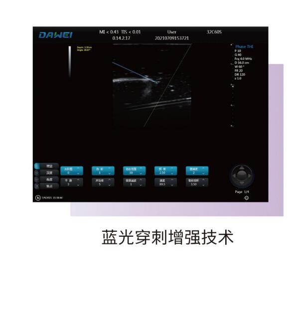 大为彩色多勒普超声诊断仪3